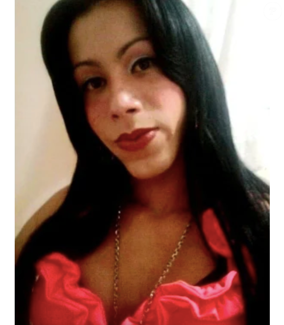 Juju do Pix surpreende com mudança radical após se submeter a cirurgia para remover óleo mineral de seu corpo.