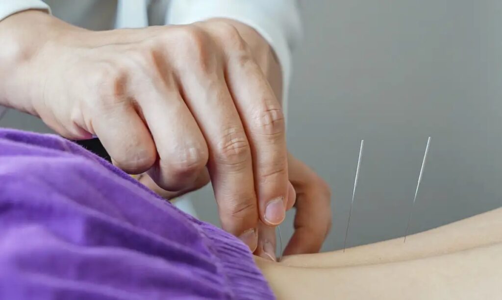 Regulamentação da prática da acupuntura no Brasil: novas diretrizes profissionais.