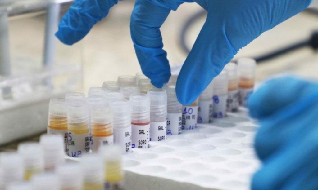 Número de casos confirmados de Mpox no país atinge 140 em 2026