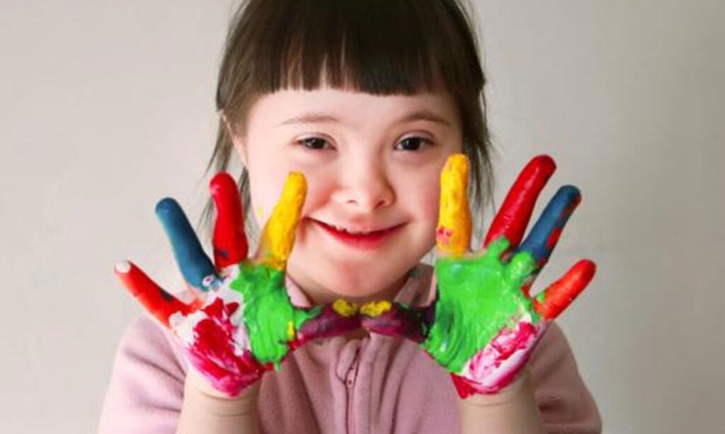 Síndrome de Down: Dia da conscientização busca promover inclusão e eliminar preconceitos